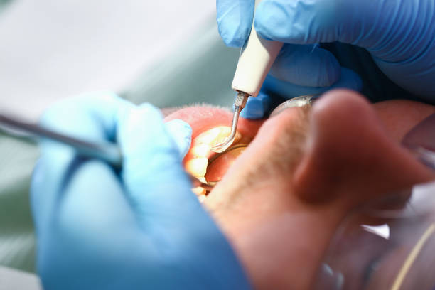 Best Emergency Denture Repair in Port Clinton, OH